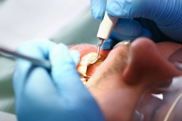 Urgent Tooth Repair in VA